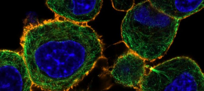 Collaboration between CIB and ZEISS continues